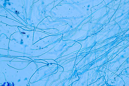 Penicillium, ascomycetous fungi are of major importance in the natural environment as well as food...