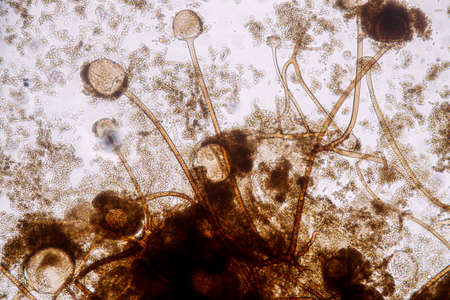 Characteristics of Rhizopus is a genus of common saprophytic fungi on Slide under the microscope for...