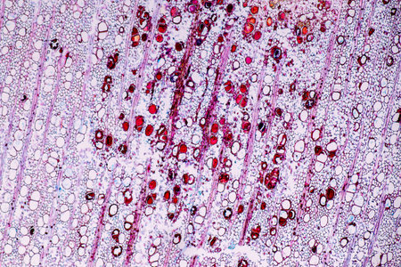 Characteristics of fungi living in wood as a group, are polyphyletic under the microscope for...
