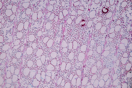 Characteristics of fungi living in wood as a group, are polyphyletic under the microscope for...