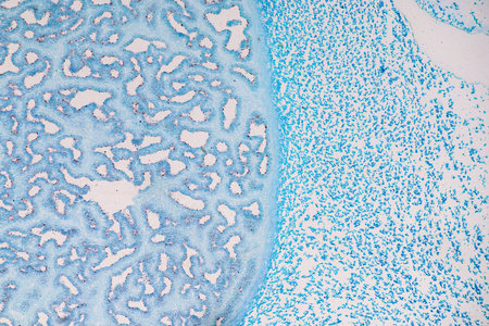 Characteristics of fungi living in wood as a group, are polyphyletic under the microscope for...