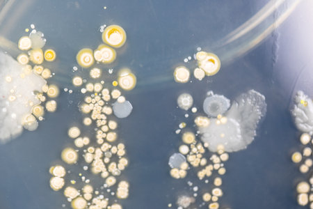 Backgrounds of Characteristics and Different shaped Colony of Bacteria and Mold growing on agar...