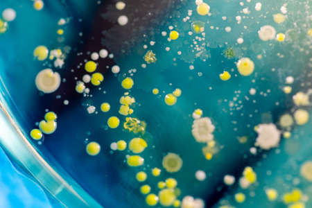 Backgrounds of Characteristics and Different shaped Colony of Bacteria and Mold growing on agar...