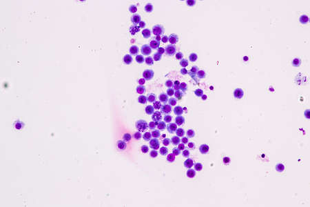 Chromosomes Human under the microscope for education.