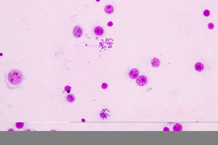 Chromosomes Human under the microscope for education.