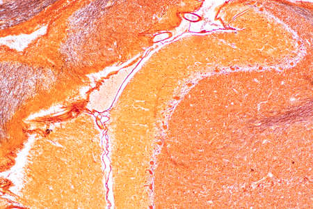Cerebellum, Thalamus, Medulla oblongata, Spinal cord and Motor Neuron human under the microscope in...