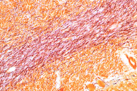Cerebellum, Thalamus, Medulla oblongata, Spinal cord and Motor Neuron human under the microscope in...