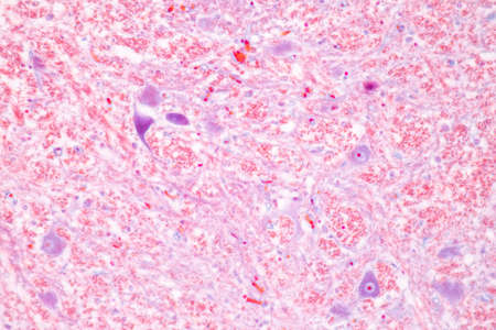 Cerebellum, Thalamus, Medulla oblongata, Spinal cord and Motor Neuron human under the microscope in...