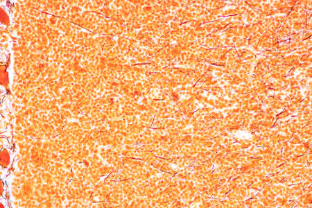 Cerebellum, Thalamus, Medulla oblongata, Spinal cord and Motor Neuron human under the microscope in...
