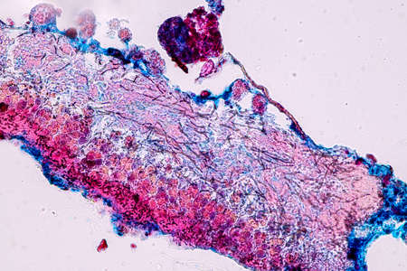 Characteristics of Lichen, hyphae and Symbiotic algae under the microscope for education.