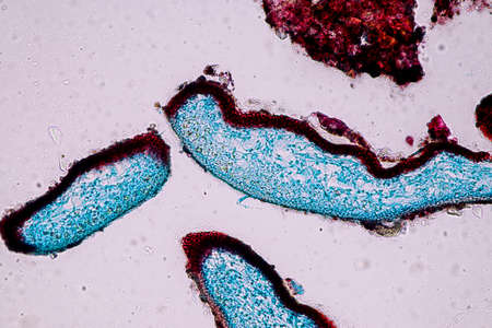 Characteristics of Lichen, hyphae and Symbiotic algae under the microscope for education.