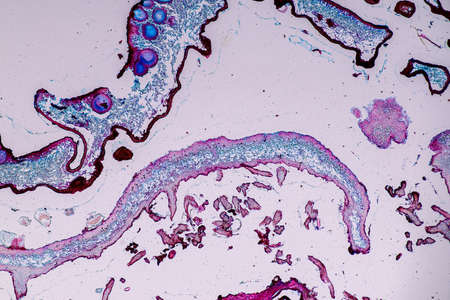 Characteristics of Lichen, hyphae and Symbiotic algae under the microscope for education.の写真素材