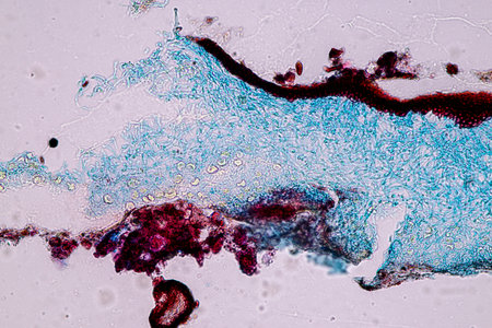 Characteristics of Lichen, hyphae and Symbiotic algae under the microscope for education.