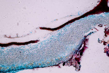 Characteristics of Lichen, hyphae and Symbiotic algae under the microscope for education.