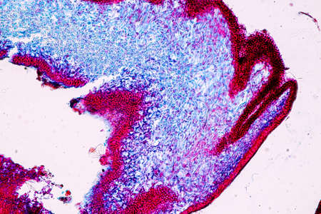 Characteristics of Lichen, hyphae and Symbiotic algae under the microscope for education.