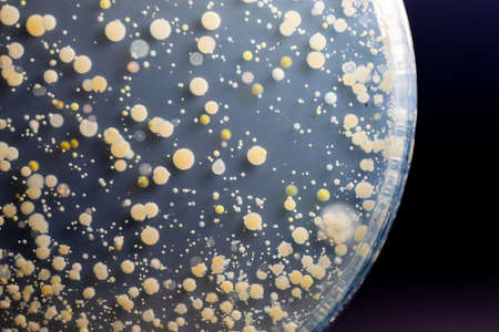 Backgrounds of Characteristics and Different shaped Colony of Bacteria and Mold growing on agar...
