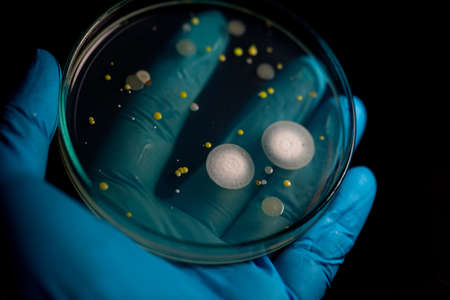 Backgrounds of Characteristics and Different shaped Colony of Bacteria and Mold growing on agar plates from Soil samples for education in Microbiology laboratory.の写真素材