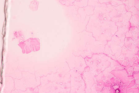 Anatomy and Histological Ovary, Testis and Sperm human cells under microscope.の写真素材