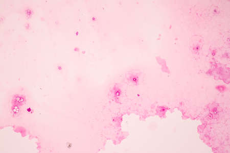 Anatomy and Histological Ovary, Testis and Sperm human cells under microscope.の写真素材