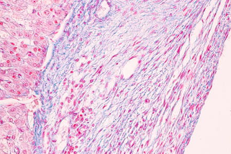 Anatomy and Histological Ovary, Testis and Sperm human cells under microscope.