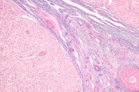 Anatomy and Histological Ovary, Testis and Sperm human cells under microscope.