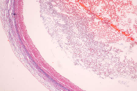Anatomy and Histological Ovary, Testis and Sperm human cells under microscope.の写真素材