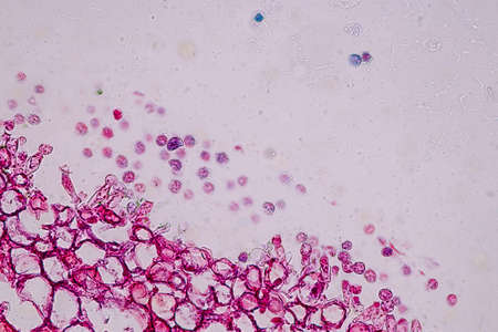 Host cells with spores (mold) are inside wood under the microscope for education.