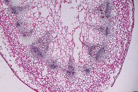 Host cells with spores (mold) are inside wood under the microscope for education.