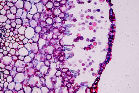 Host cells with spores (mold) are inside wood under the microscope for education.