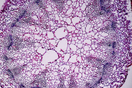 Host cells with spores (mold) are inside wood under the microscope for education.