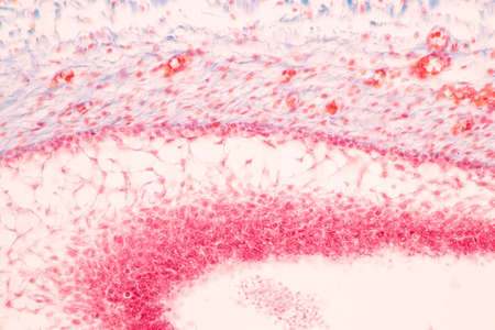 Tooth development from human under microscope view for education.