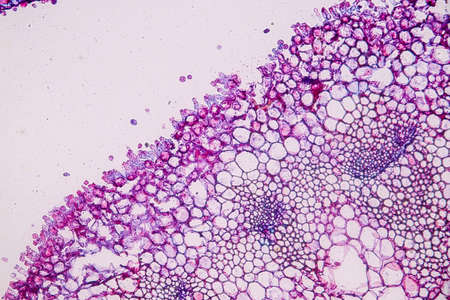 Host cells with spores (mold) are inside wood under the microscope for education.