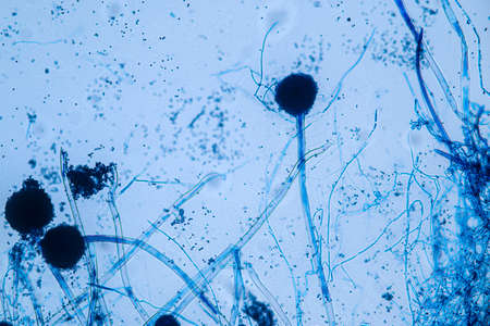 Aspergillus niger and Aspergillus oryzae  (mold) under microscope for Microbiology in Lab.