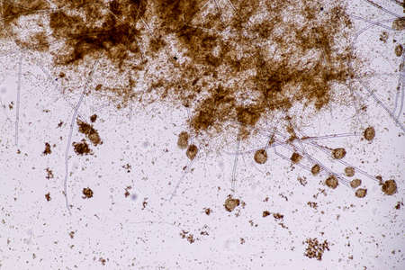 Aspergillus niger and Aspergillus oryzae  (mold) under microscope for Microbiology in Lab.