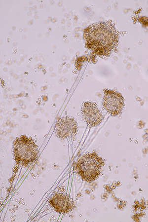 Aspergillus niger and Aspergillus oryzae  (mold) under microscope for Microbiology in Lab.