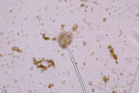 Aspergillus niger and Aspergillus oryzae  (mold) under microscope for Microbiology in Lab.