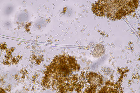 Aspergillus niger and Aspergillus oryzae  (mold) under microscope for Microbiology in Lab.
