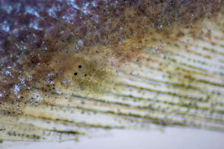 Parasitic (Argulus sp.), Study of Argulus sp. under microscope view in laboratory.の写真素材