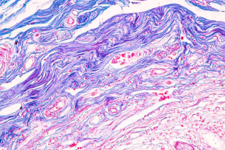 Tissue of Small intestine (Duodenum) and Vermiform appendix  Human under the microscope in Lab.の写真素材