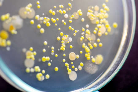 Backgrounds of Characteristics and Different shaped Colony of Bacteria and Mold growing on agar plates from Soil samples for education in Microbiology laboratory.の写真素材