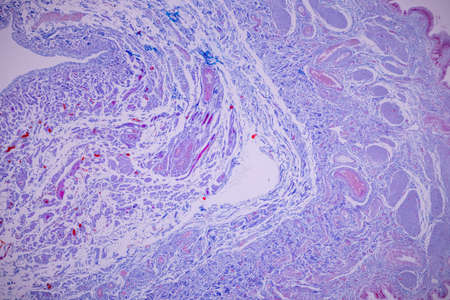 Columnar epithelium of human gall bladder under the microscope in Lab.