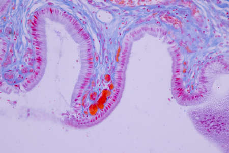 Columnar epithelium of human gall bladder under the microscope in Lab.の写真素材