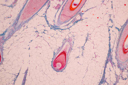 Scalp and hair follicles of human under the microscope in Lab.