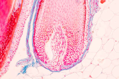 Scalp and hair follicles of human under the microscope in Lab.