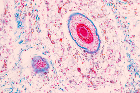 Scalp and hair follicles of human under the microscope in Lab.