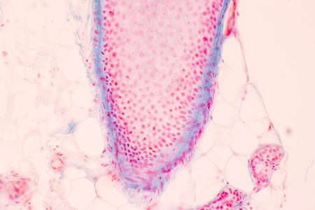 Scalp and hair follicles of human under the microscope in Lab.