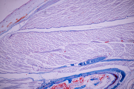 Hyaline cartilage, Elastic cartilage and Bone Human under the microscope in Lab.