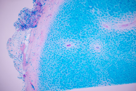 Hyaline cartilage, Elastic cartilage and Bone Human under the microscope in Lab.