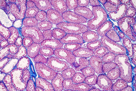 Anatomy and Histological Epididymis and Testis human cells under microscope.