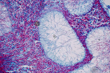 Host cells with spores (mold) are inside wood under the microscope for education.
